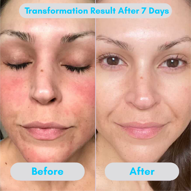 Seora Radiance+ Cream