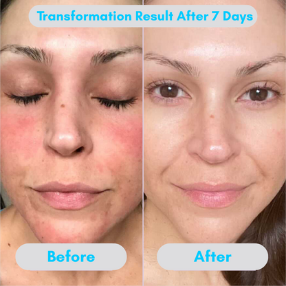 Seora Radiance+ Cream