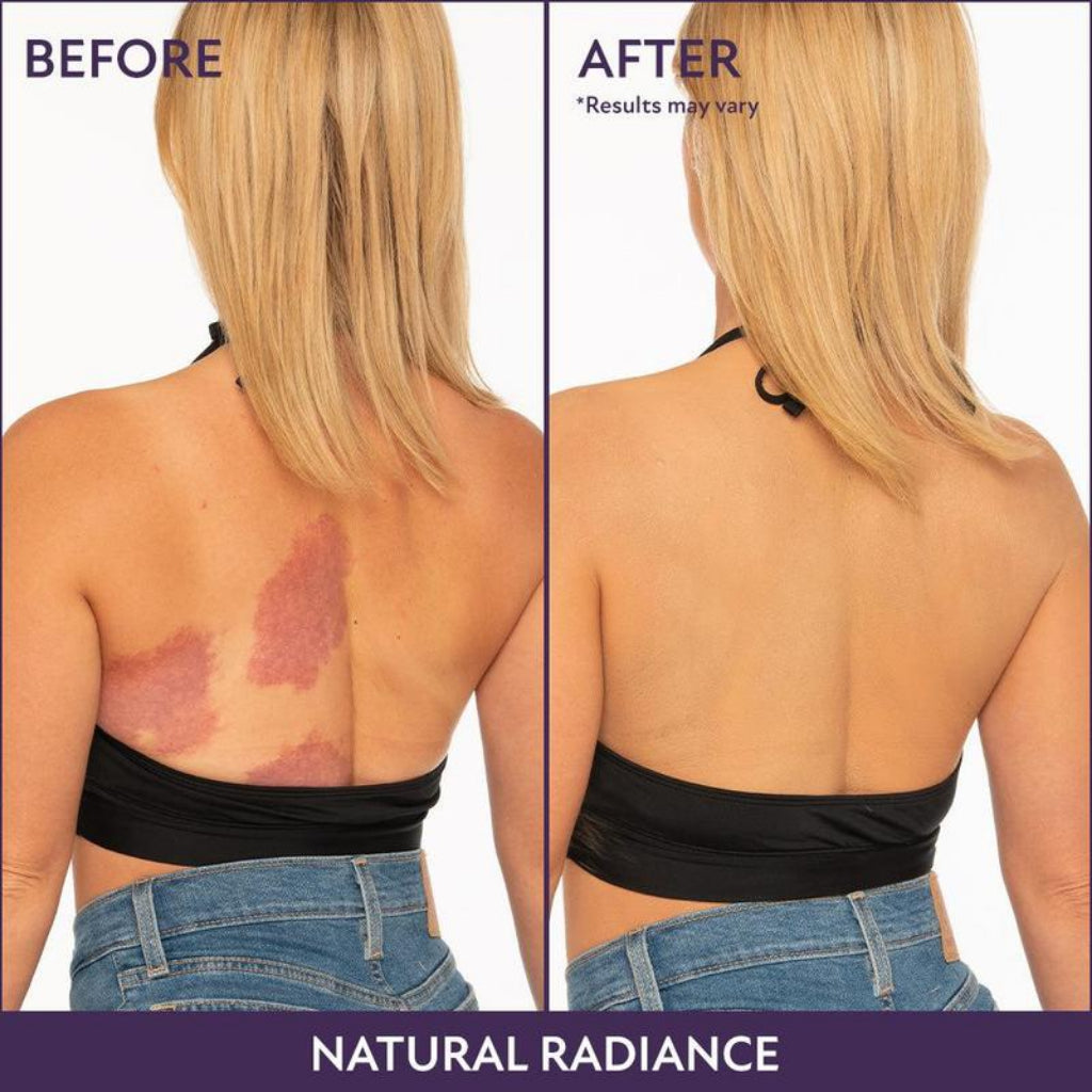 Concealé™ - Perfecta Body Blur