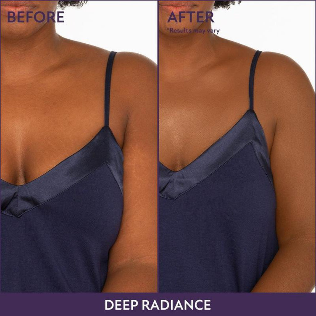 Concealé™ - Perfecta Body Blur