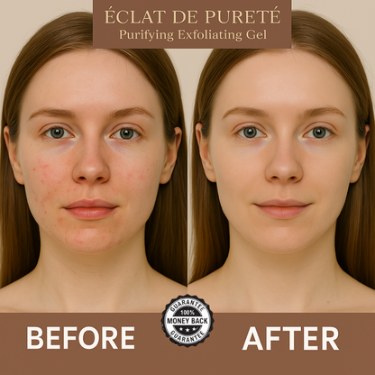 Éclat de Pureté™