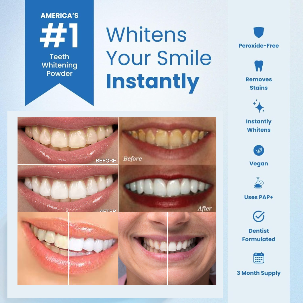 WhitenEase™